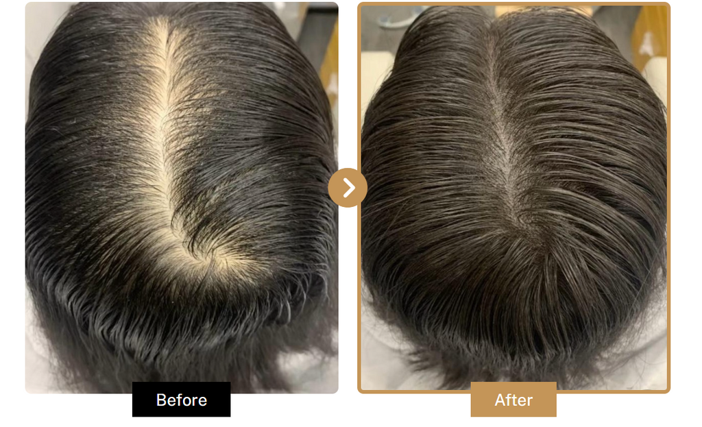 G9 SCALP Solution