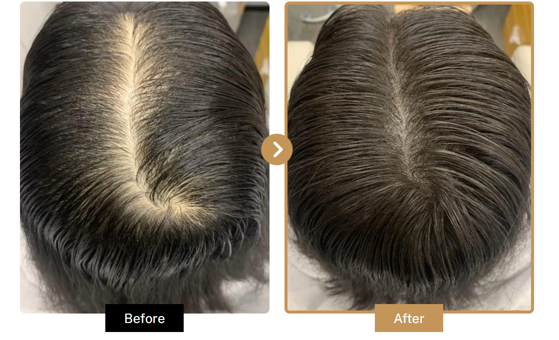 G9 SCALP Solution